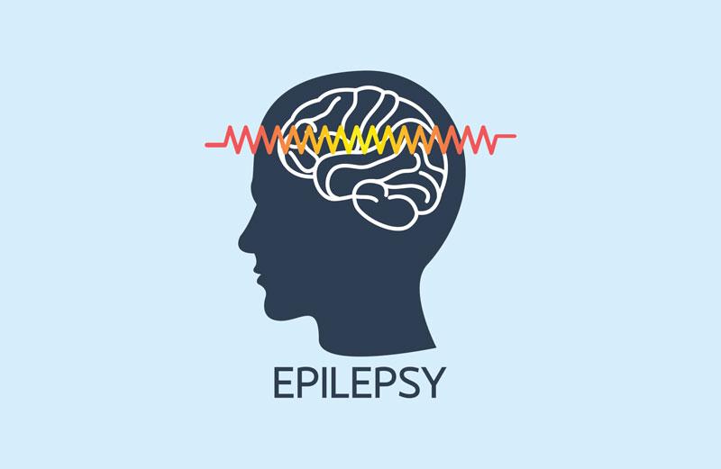 What is Epilepsy?