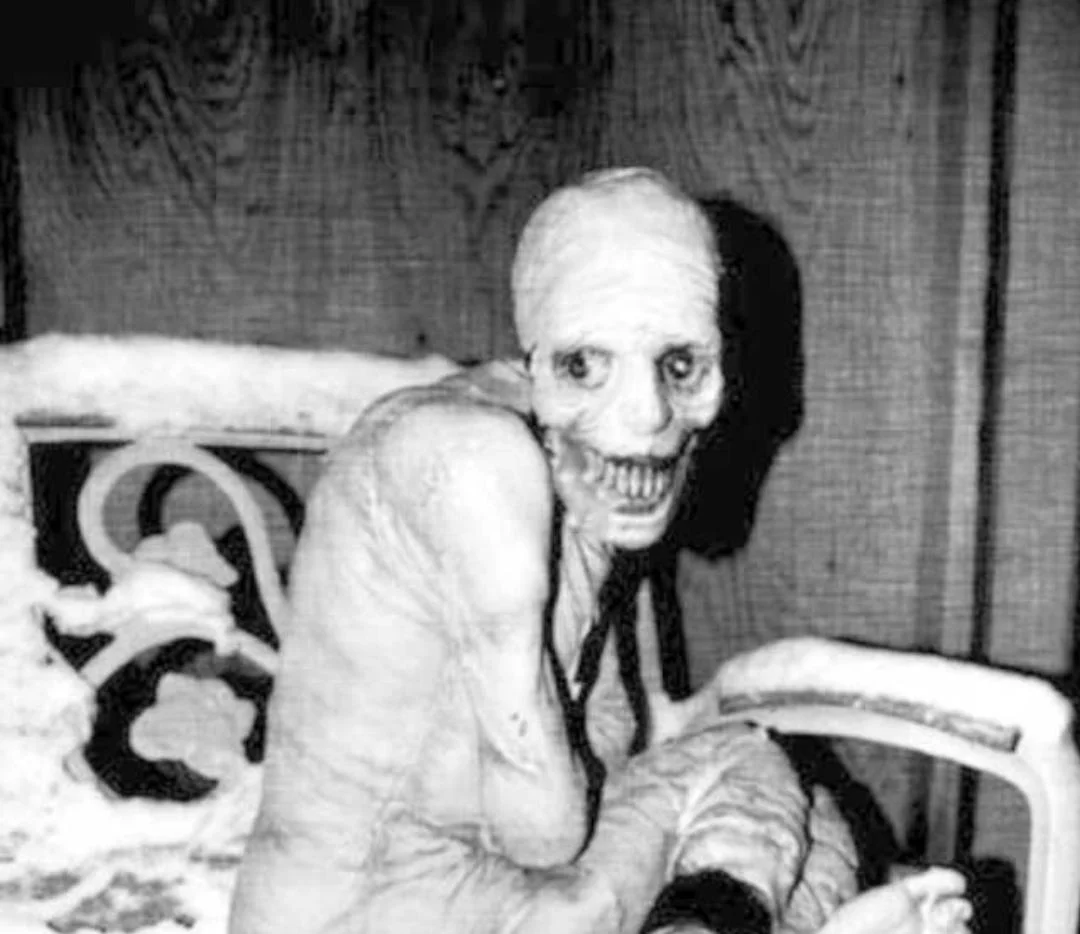 Story of The Russian Sleep Experiment